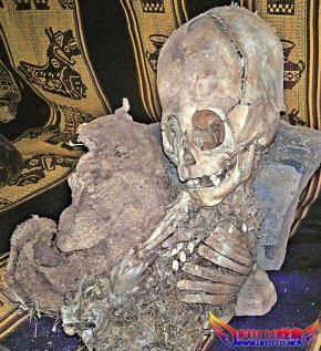 秘鲁‧三角形头骨‧眼窝特大‧发现外星人遗骸