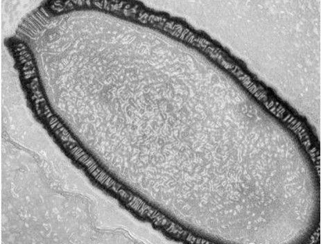 巨型病毒阔口罐病毒(Pithovirus sibericum)