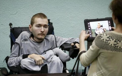 世界首例头颅移植手术的俄罗斯男子Valery Spiridonov